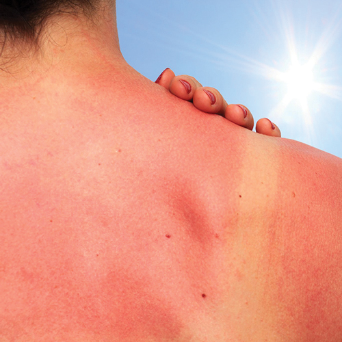 Dr Megan @ Home: Skin Cancer Awareness